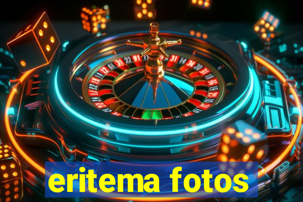 eritema fotos