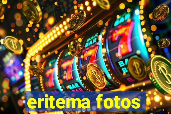 eritema fotos